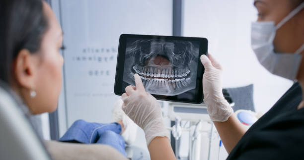 Licensed Dental Implants service in Buffalo, TX - Smile Center Dentistry