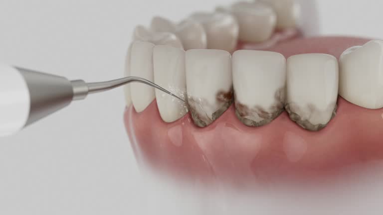 Reliable Dental Implants contractor in Buffalo, TX by Smile Center Dentistry